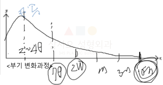 안면윤곽수술 후 부기 빠지는 시기 및 냉찜질 온찜질 관리 팁