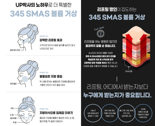 SMASリフトと脂肪移植・吸引を同時に？SMASボリューム挙上の特徴と効果