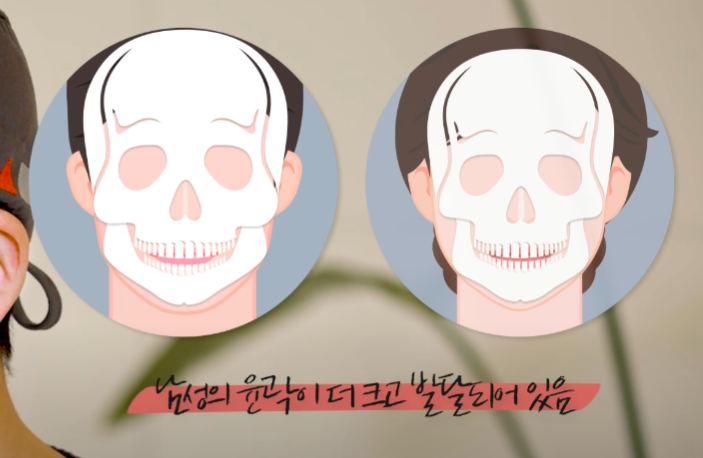 Male Facial Contouring: Key Differences from Female Surgery and Essential Considerations Guide