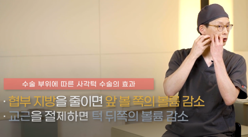 사각턱 수술 후기 전 필독! 수술 과정과 피질절골·교근축소 용어 정리