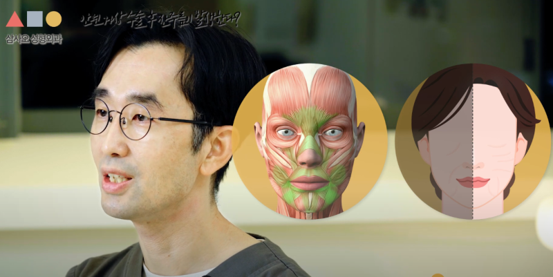 안면거상술 효과 및 유지 기간, 재수술 가능성과 주의사항 총정리