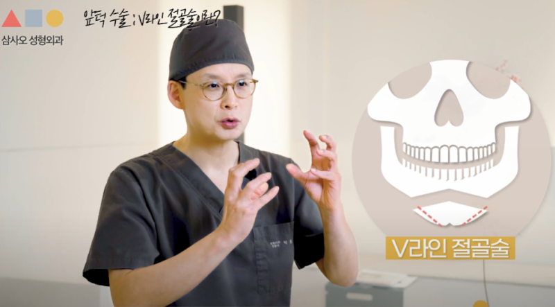 下巴整形手术种类与特点全解析：从V-line截骨术到环切术的差异