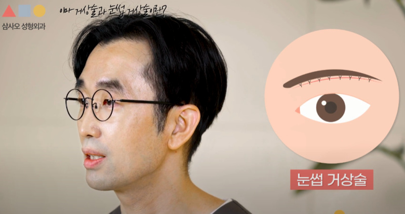 눈 처짐 개선: 내시경이마거상 vs 눈썹 거상술 차이점과 나에게 맞는 수술법