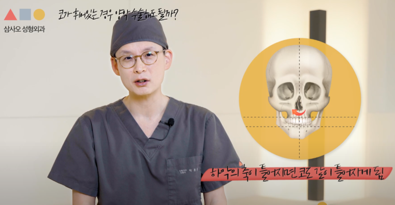 面部不对称矫正：面部轮廓手术与双鄂手术，哪种更适合我？