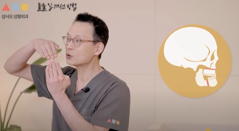 Phẫu thuật hàm hô vs Niềng răng nhổ răng: Hướng dẫn phân tích theo từng loại và phương pháp điều trị phù hợp
