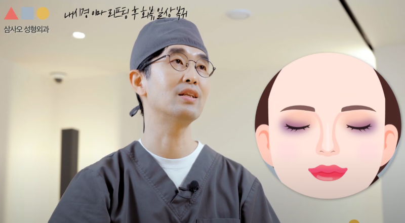 额头提升术前必看清单：内窥镜额头提升的效果与恢复期