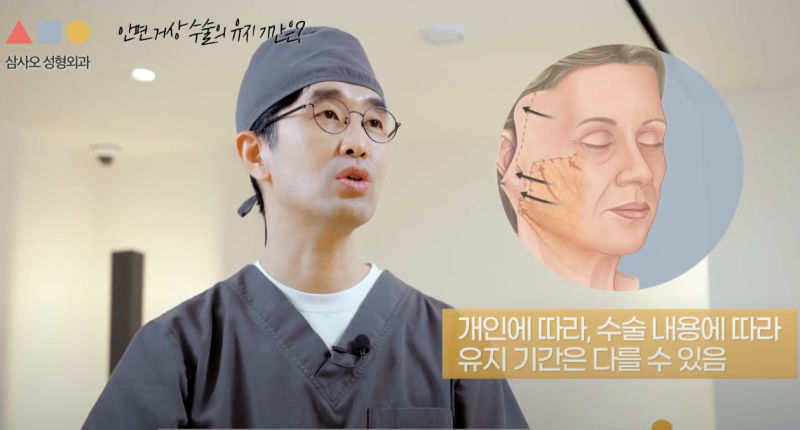안면거상 리프팅 유지기간, 효과 오래 지속되는 비결과 사후관리법