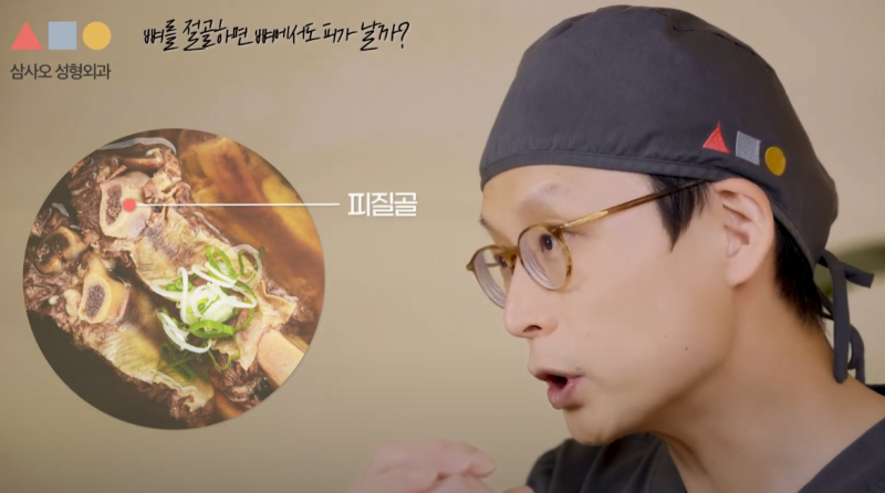 안면윤곽 수술 과정 속 피줄(드레인) 역할: 안전한 회복을 위한 필수 조건