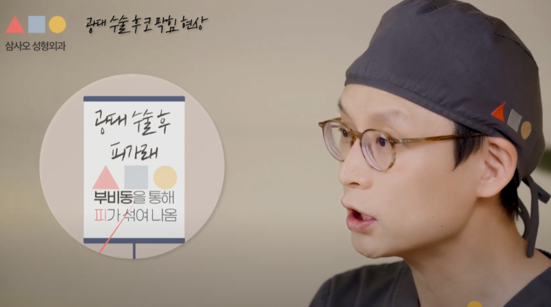광대윤곽 후 코피와 피가래, 왜 날까요? 원인과 주의사항 총정리