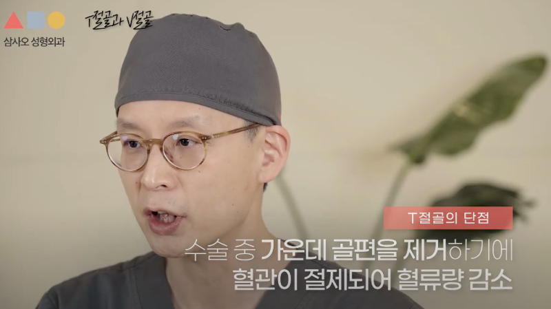下巴手术T字截骨 vs V字截骨差异与恢复期全面解析