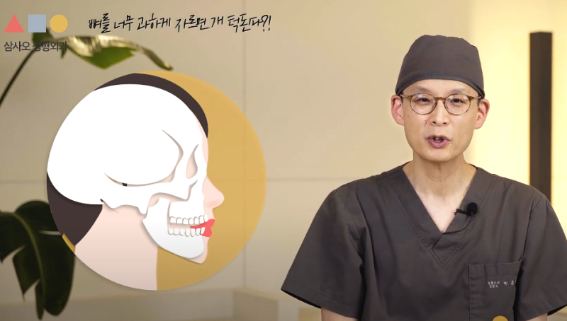 Must Check Before Behind-the-Ear Square Jaw Surgery! The Core of Mandibular Reduction Without "Dog Jaw" Side Effects
