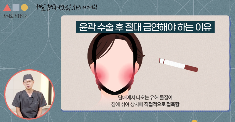 5 Tips to Quickly Reduce Swelling After Facial Contouring: How to Shorten Your Recovery Time