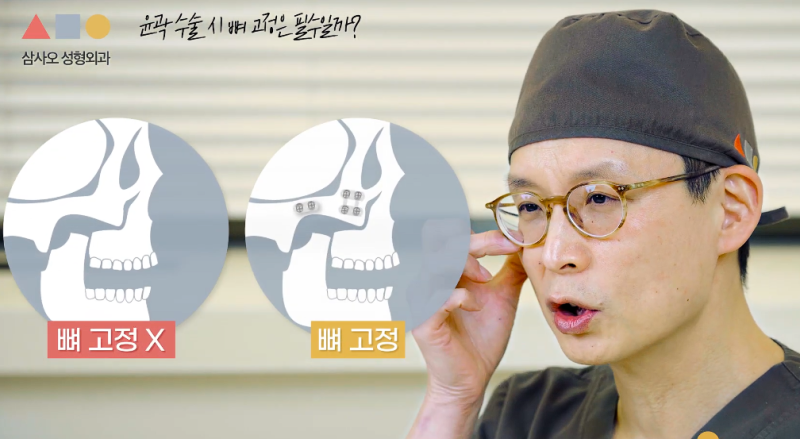 윤곽, 양악 수술 후 레이저 시술 받아도 되나요? 뼈박사가 알려드립니다 사진 11