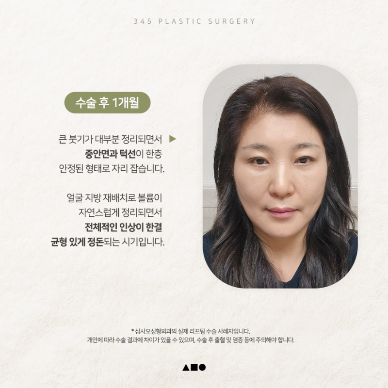 내시경이마거상 붓기, 언제 자연스러워질까요? 실제 회복 과정 공개 사진 4