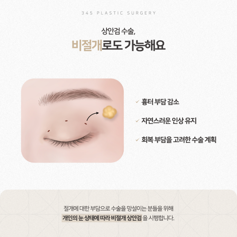 상안검 수술, 꼭 절개해야 할까요? 비절개 상안검 알아보기 사진 3