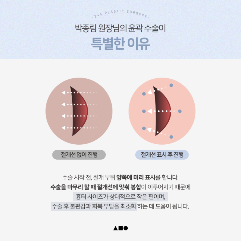 20대 남성 윤곽3종 후기, 붓기 변화 6개월 경과 사진 6