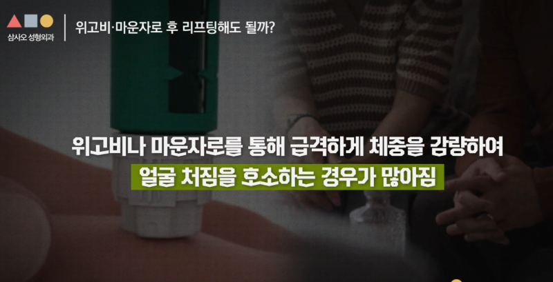 다이어트와 리프팅 중 어떤 것을 먼저해야 할까? 삼사오성형외과 알려드립니다 사진 5