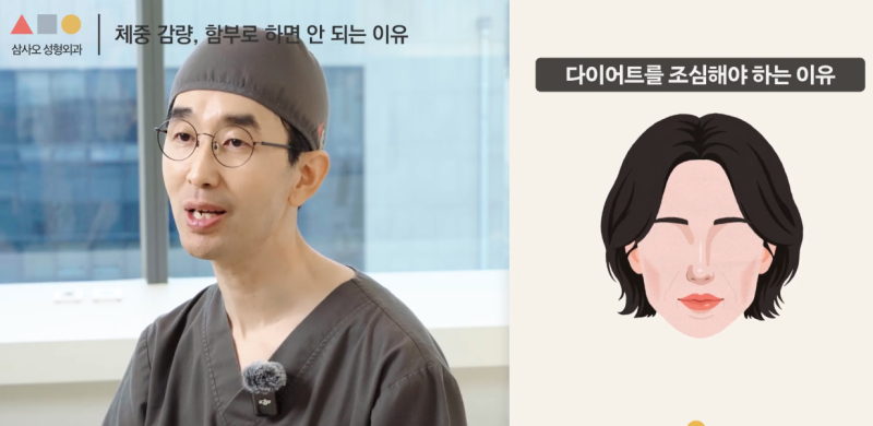 다이어트와 리프팅 중 어떤 것을 먼저해야 할까? 삼사오성형외과 알려드립니다 사진 8