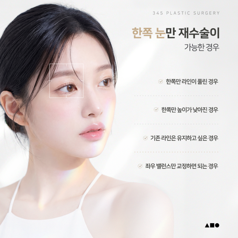 한쪽만 풀린 쌍꺼풀, 한쪽눈재수술로 가능할까요? 사진 5