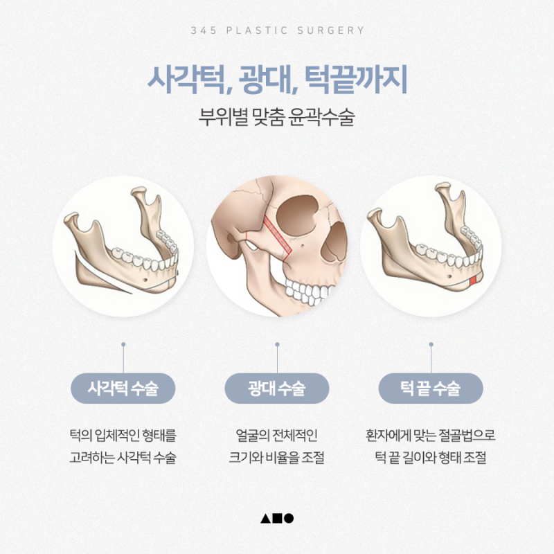 남자 윤곽수술, 자연스러운 얼굴 비율을 만드는 방법 사진 4