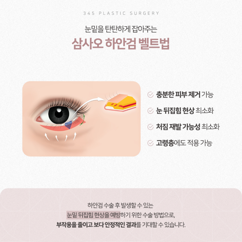 하안검 재수술, 더 신중한 접근이 필요한 이유 사진 3