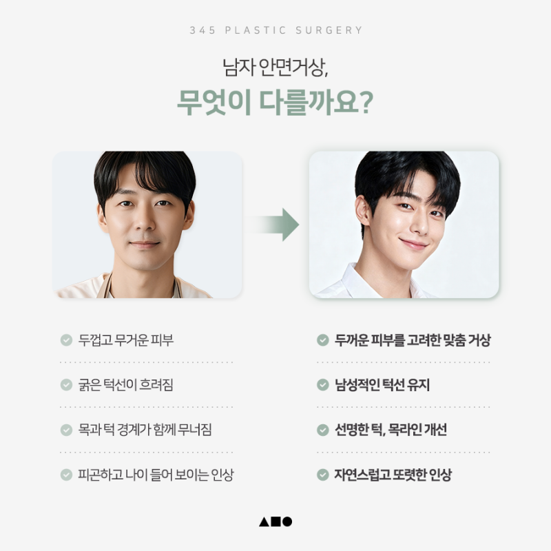 남자 안면거상, 여성과 무엇이 다를까요?