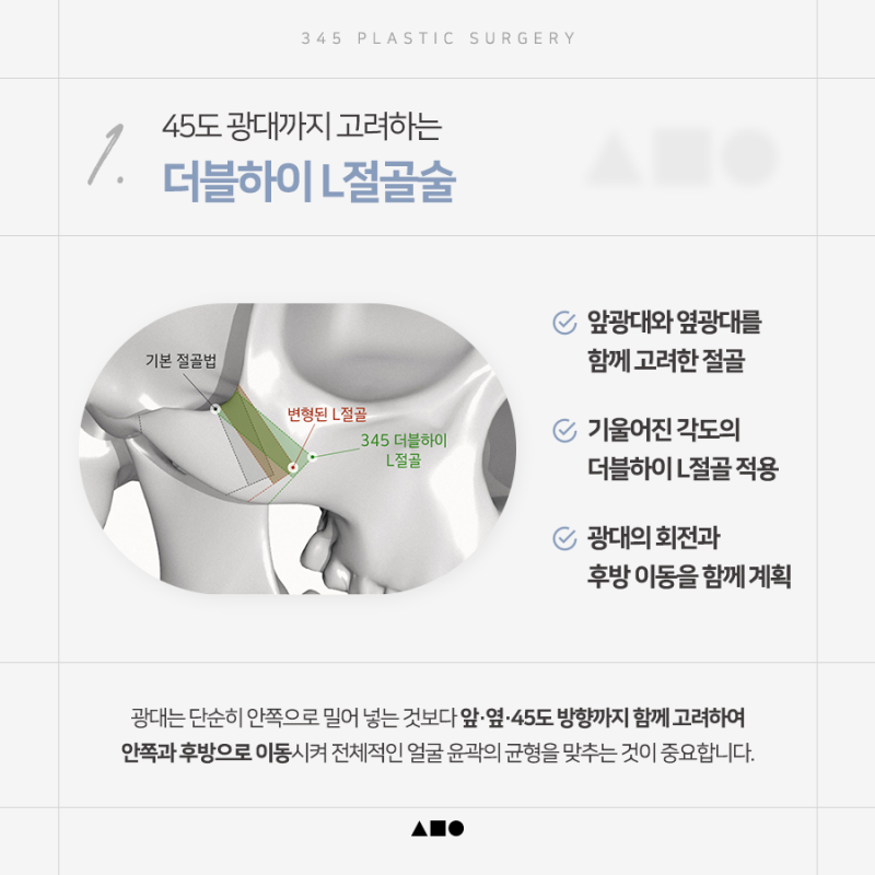 광대, 사각턱, 턱끝까지 함께 고려해야 하는 이유? 삼사오 윤곽 3종 사진 4