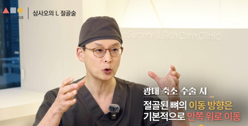 광대축소술, 절골 방식이 결과를 좌우합니다 사진 4