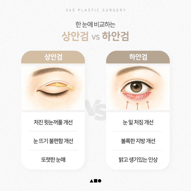 내 눈에 필요한 건 상안검일까, 하안검일까? 사진 5