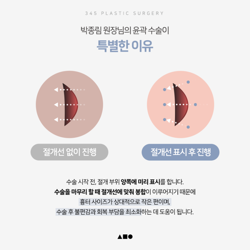 20대 여성 윤곽 2종(사각턱, 앞턱) 리얼 붓기 변화 사진 6