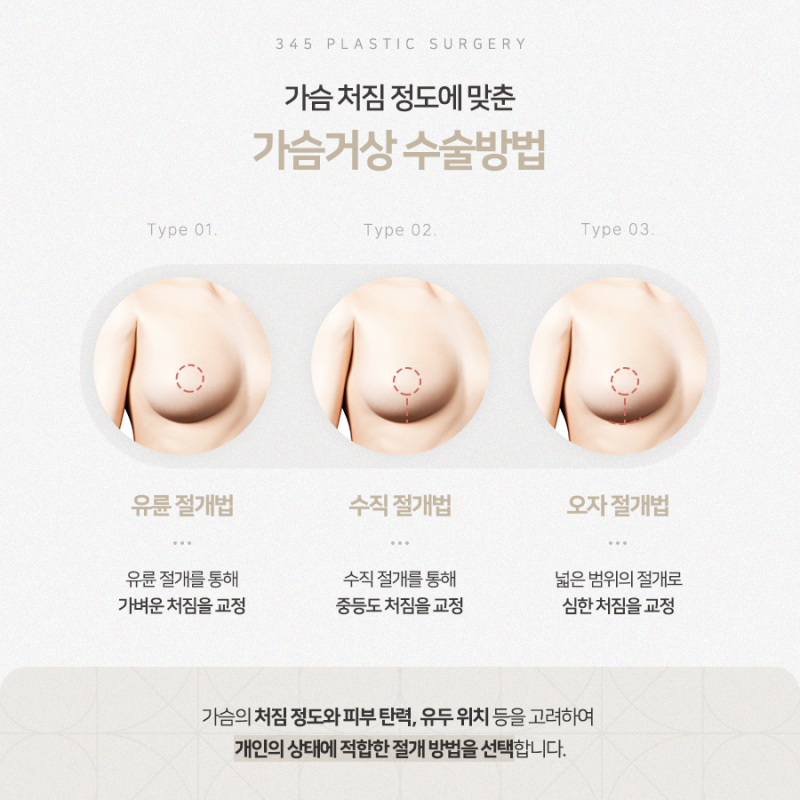 출산·다이어트 후 처진 가슴, 가슴거상술 방법은? 사진 4