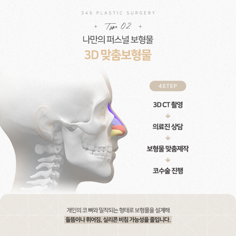 무보형물 코성형 vs 맞춤보형물, 내 코에는 어떤 방법이 맞을까? 사진 4