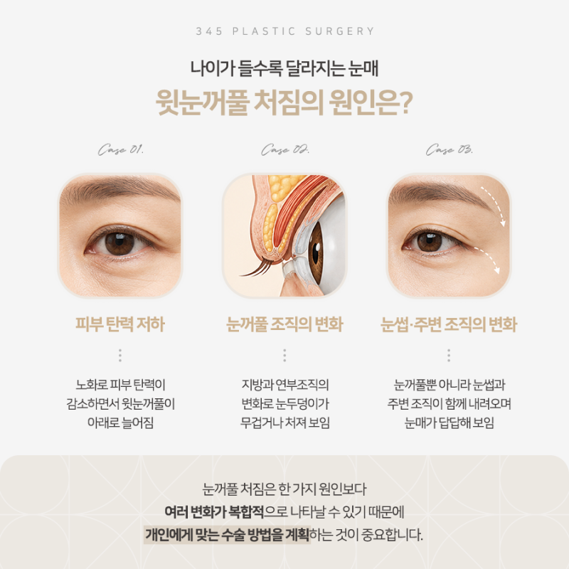눈꺼풀이 처지고 쌍꺼풀이 덮인다면? 상안검수술 알아보기 사진 3
