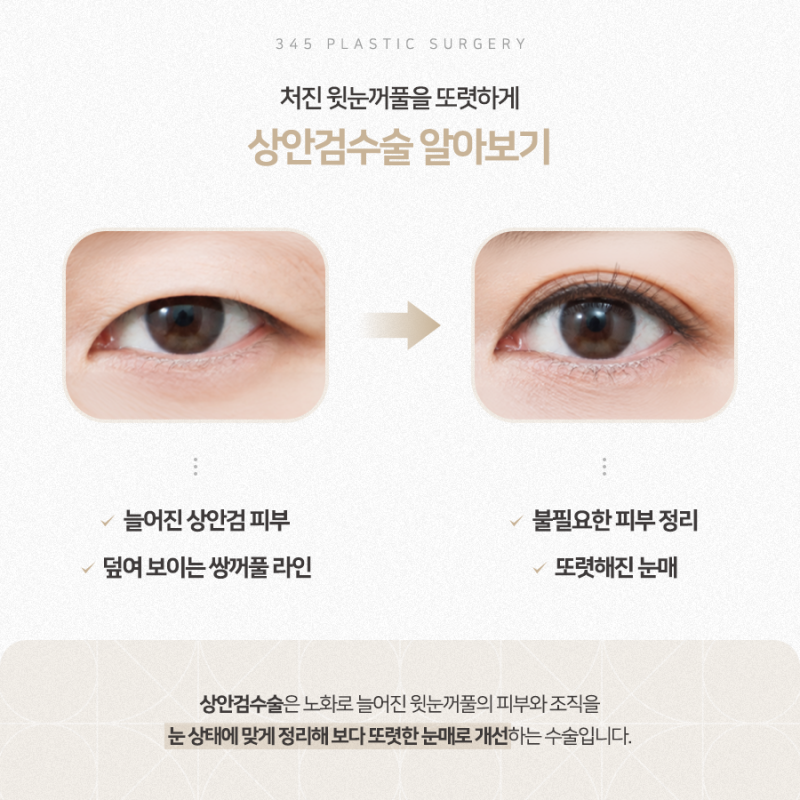 눈꺼풀이 처지고 쌍꺼풀이 덮인다면? 상안검수술 알아보기 사진 4