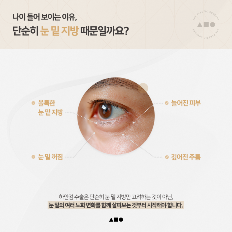 하안검수술, 재수술이라면 더 꼼꼼하게 살펴봐야 하는 이유