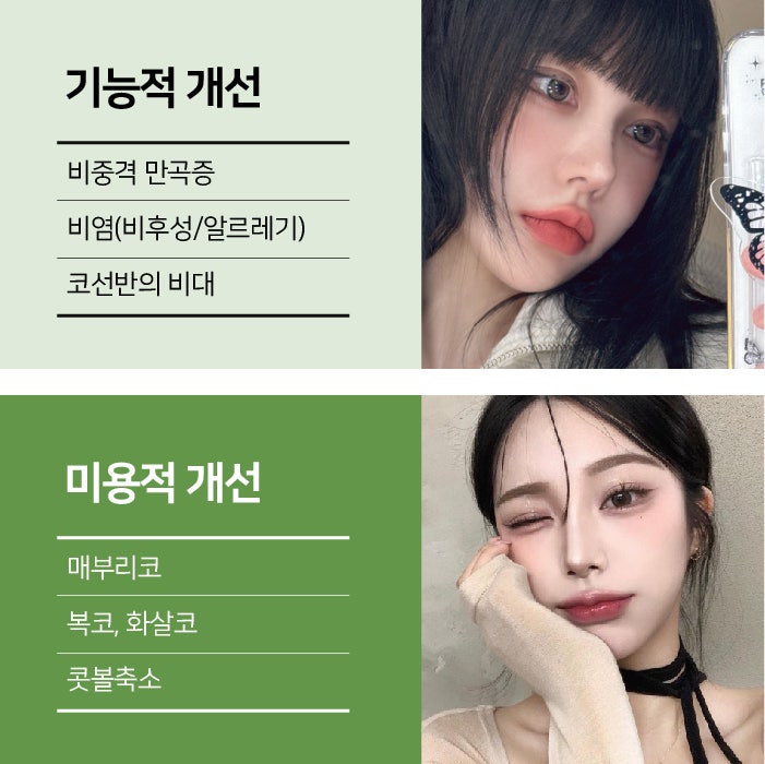 부산기능코수술 기능과 미용, 개인 상태에 맞게 고려