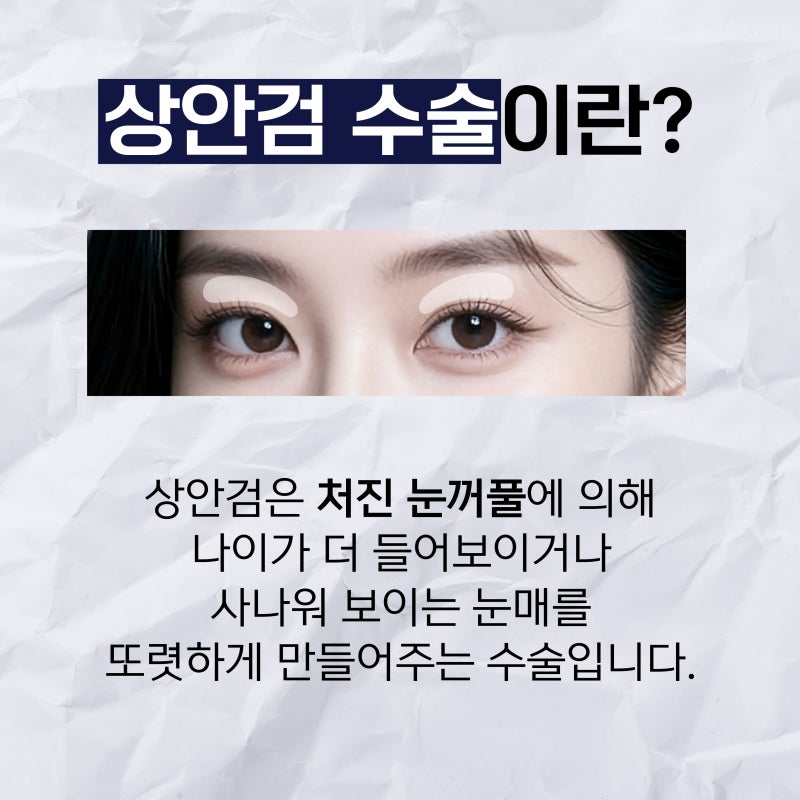 부산상안검 시간이 지날수록 눈꺼풀이 처진다면
