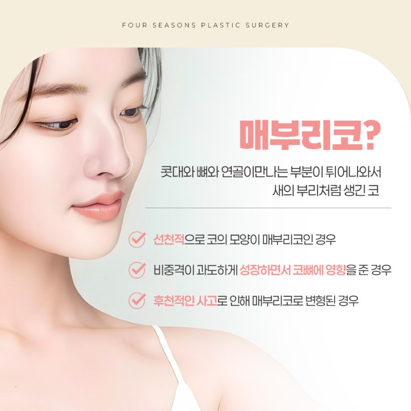부산매부리코 자가조직을 사용하는 이유