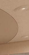서초백반증레이저 고민이면 사진 12