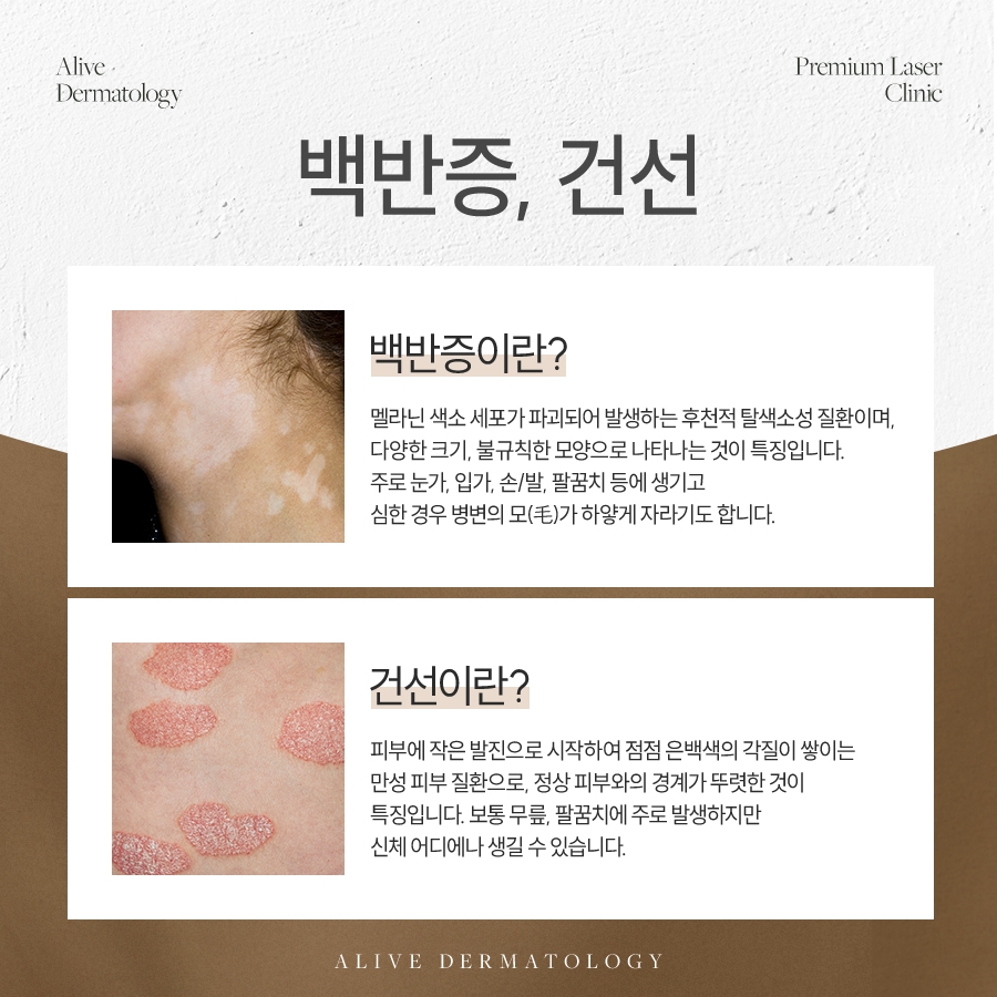 서초건선 정직하게