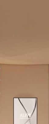 서초레이저토닝 병변에 맞게 진행 사진 18