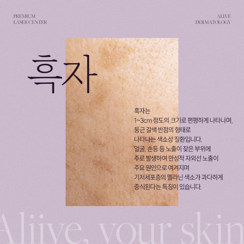 서초레이저토닝 병변에 맞게 진행 사진 4