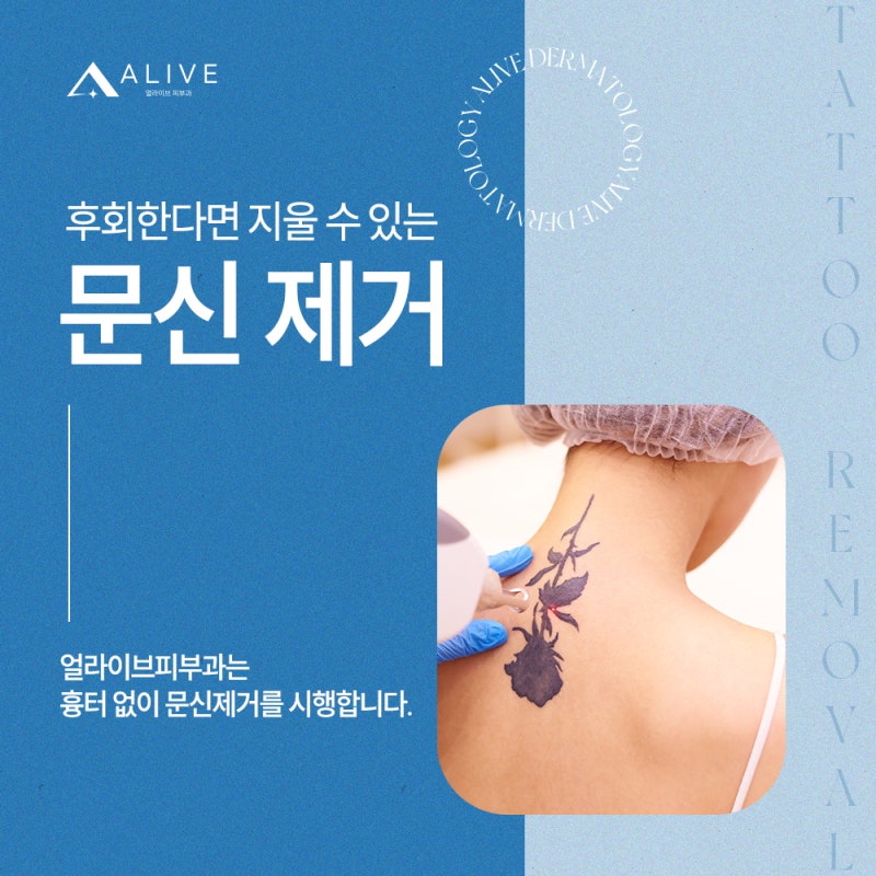고속터미널문신제거 피코웨이로 받아야 하는 이유는?