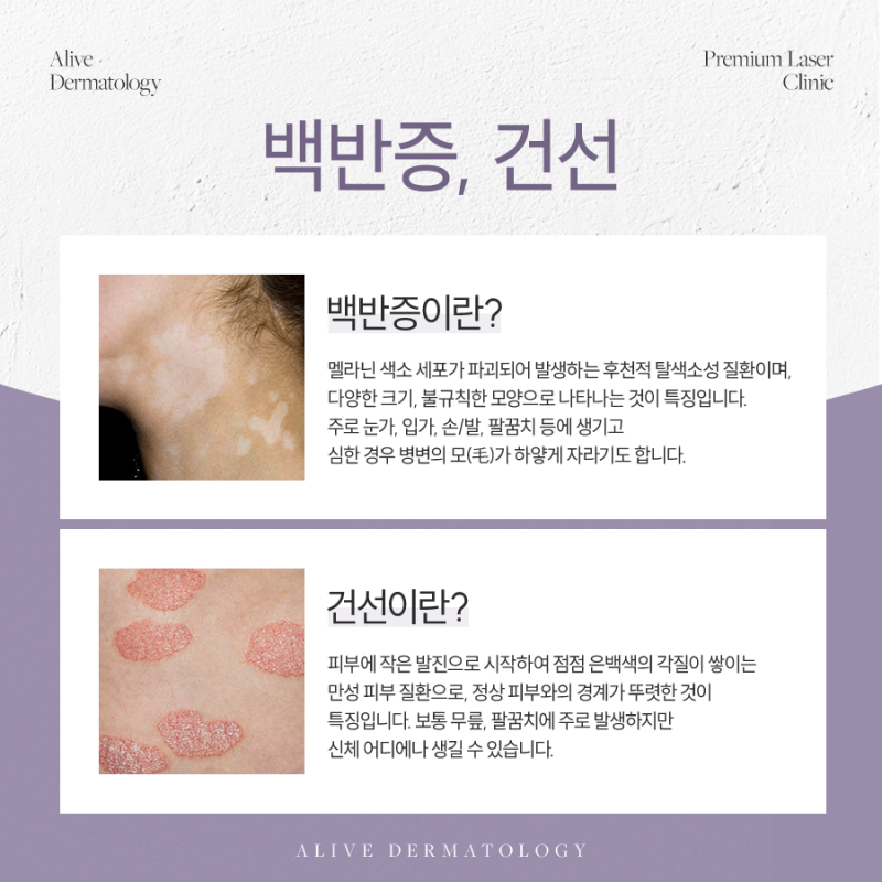 방배동백반증, 고민하고 있다면?
