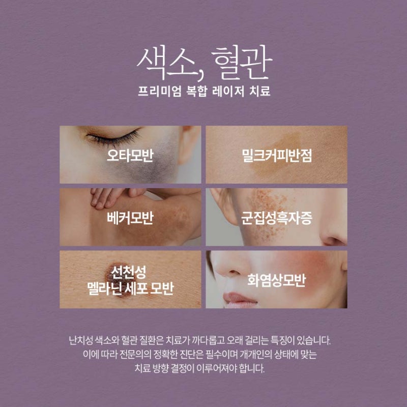 반포역색소, 제대로 관리해야 합니다.