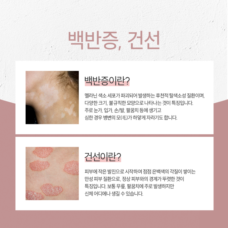 고속터미널역건선, 왜 나에게 생겼을까?