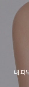 고속터미널여드름, 왜 계속 생길까? 유형부터 관리법까지 사진 25