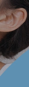 고속터미널여드름, 왜 계속 생길까? 유형부터 관리법까지 사진 21