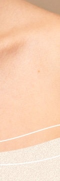반포사마귀치료, 초기에 정확히 관리해야 하는 이유 사진 21