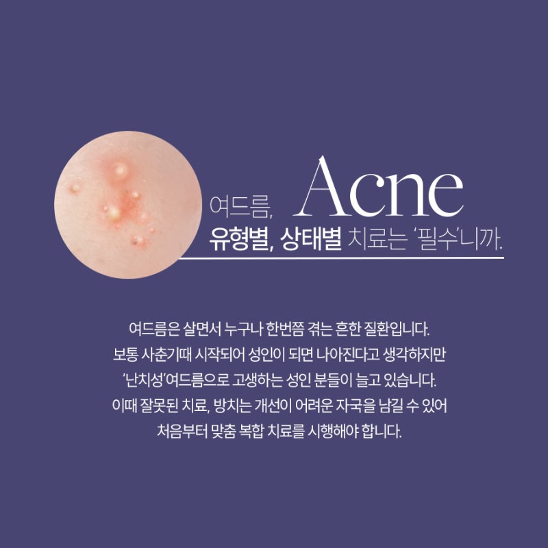 동작여드름치료, 필요한 건 피부 상태에 맞는 맞춤형 접근